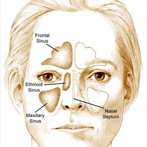 Swollen Sinuses Clear Discharge 