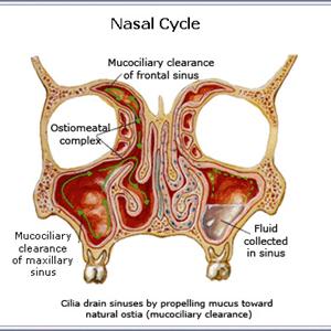 Sinus Odor Cures - Taking A Look At The Leading Causes Of Sinusitis