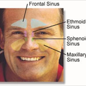 Causes Of Reocurring Sinus Infections - How To Tell If You Have Sinus Infection
