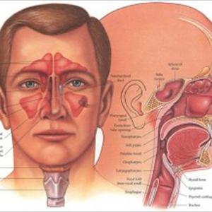  Sinusitis Overview