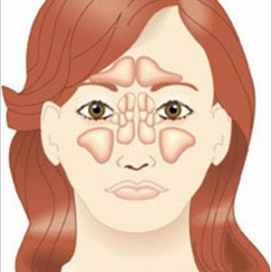 Diagram Of Sinuses - Sinus Infection