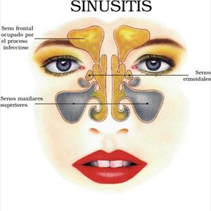 Nasal Infection - Studying The Ears, Nose As Well As Throat