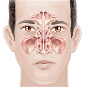 What Causes Mucus Behind Eyes - Natural Cures For Sinusitis