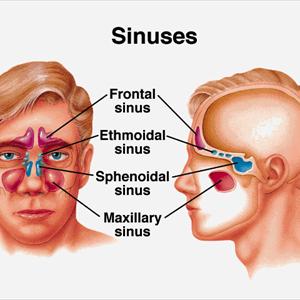 About Sinuvil - Maxillary Sinusitis - Symptoms And Treatment