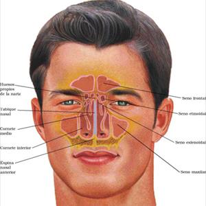 Sinusitis Contagious 