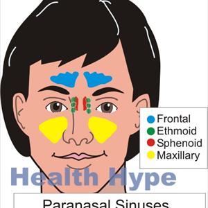 Sinus And Ear Ringing - Sinus Surgery In Indian At Mumbai And Also Delhi At Reasonably Priced Cost